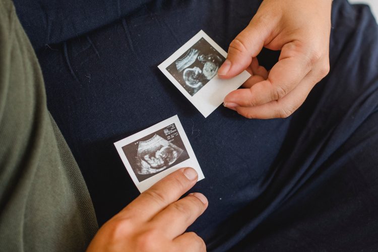 people holding pregnancy scan photos